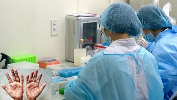 Vietnam News Today (Aug. 12): Vietnam to Produce Drugs Against Viral Monkeypox