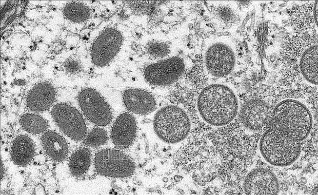 Image of monkeypox virus under an electron microscope. Photo: AFP/VNA