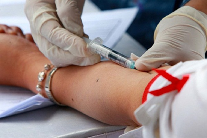 Vietnam among four countries worldwide successfully treating HIV/AIDS