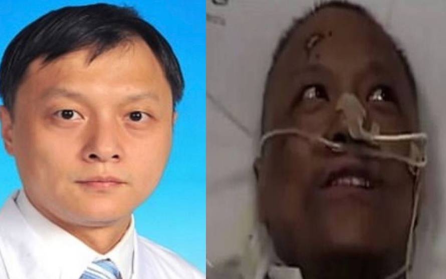 covid 19 stricken chinese doctor whose skin changed colour passed away