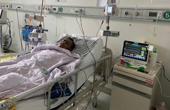 covid 19 stricken chinese doctor whose skin changed colour passed away