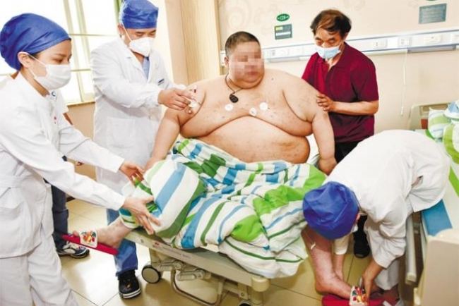 Chinese man gains over 100kg after long COVID-19 isolation