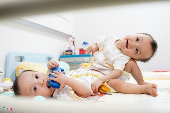 miracle of vietnamese co joined twins successfully separated after a 9 hour surgery