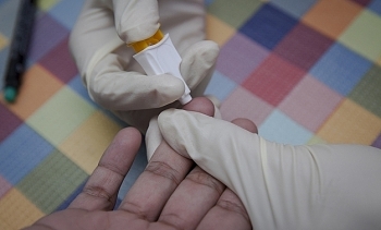 vietnam a top 4 nation with best hivaids treatment outcomes worldwide