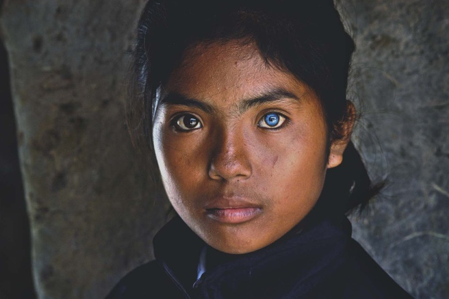 Vietnamese Girl with Different-Colored Eyes Stuns the World