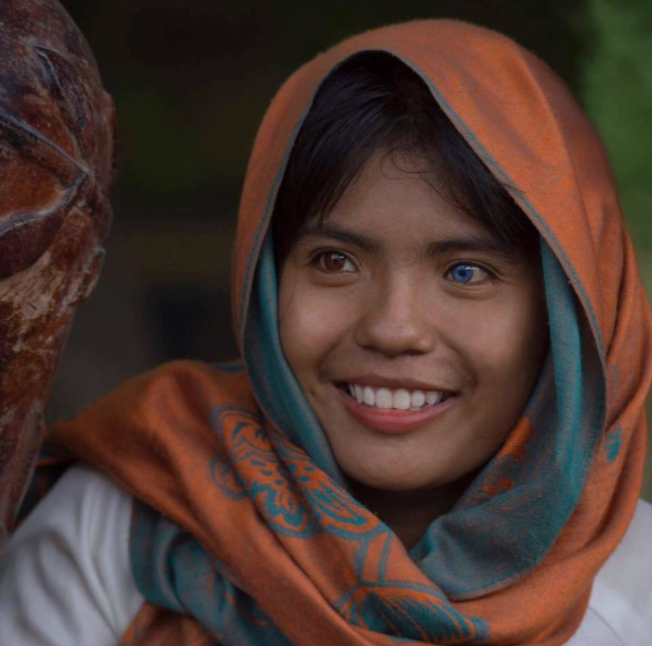 Vietnamese Girl with Different-Colored Eyes Stuns the World