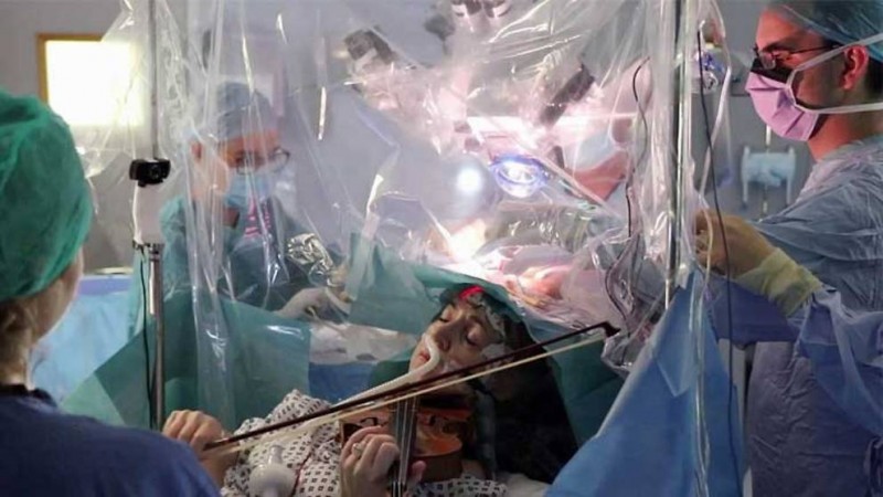 woman plays violin as surgeons remove brain tumor