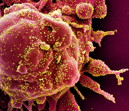 Anti-parasite drug can kill coronavirus found by researchers in Australia