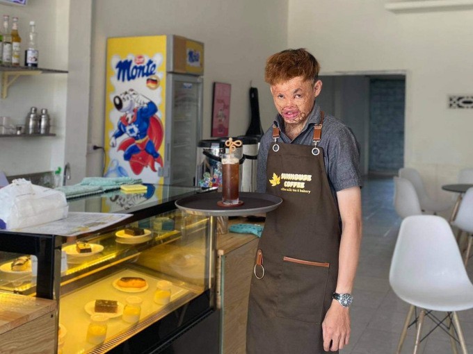 Visit Bakery & Coffee Shop of Severely Disfigured Young Man in Kon Tum