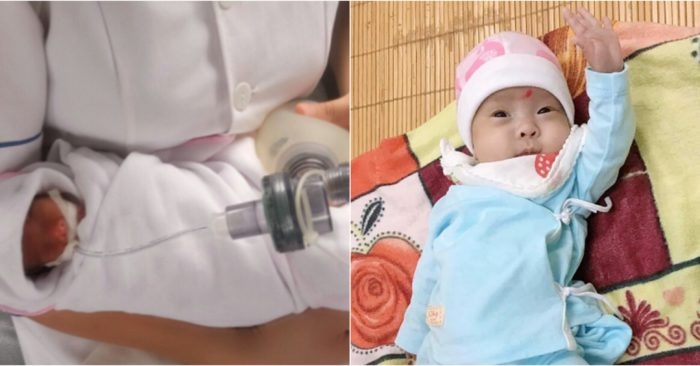 480g premature baby survives in Vinh Phuc