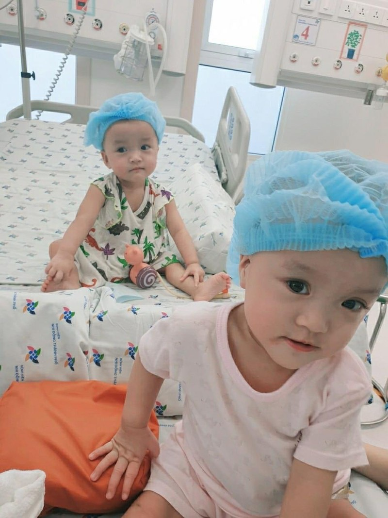 vietnamese conjoined twins to take very first steps soon after successful surgery