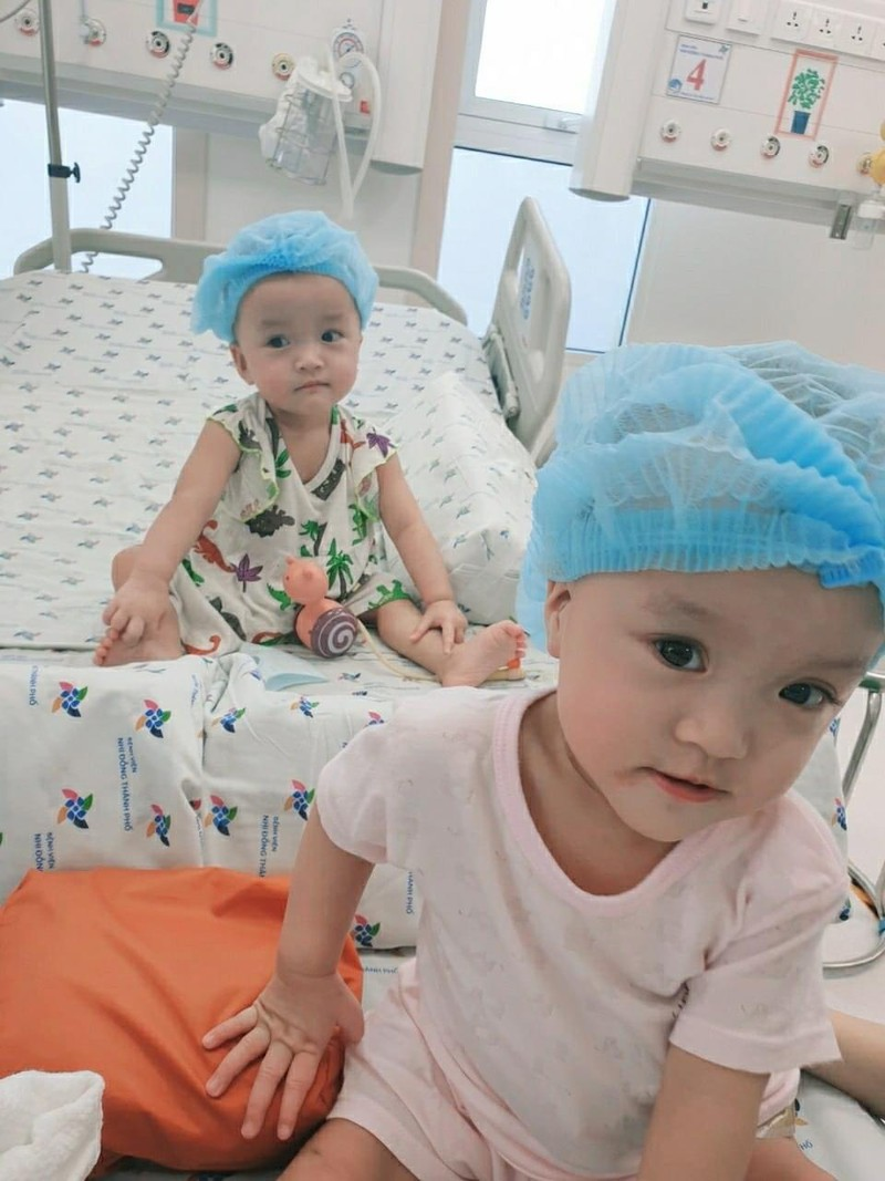 Vietnamese conjoined twins to take very first steps soon after successful surgery