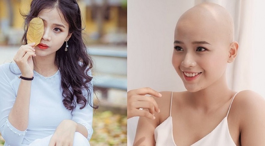 Vietnamese Girl Wins Cancer Participating In Miss World Vietnam