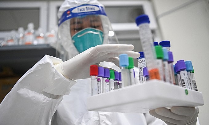 A medical staff holds a tray of Covid-19 patients' samples in Hanoi. Photo: VnExpress