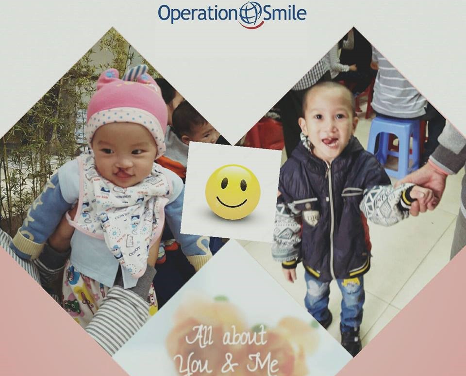 smiling week for cleft lips palates children kicks start