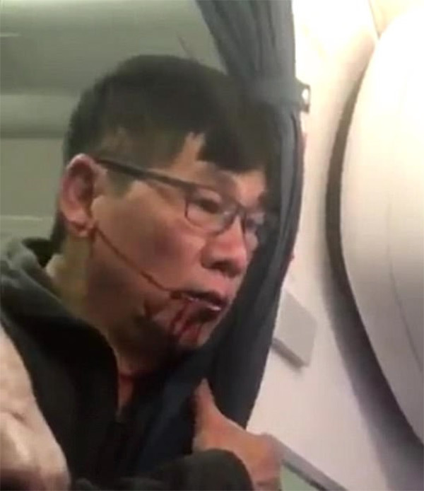 United Airline passenger could win millions after being dragged off plane: lawyer speaks