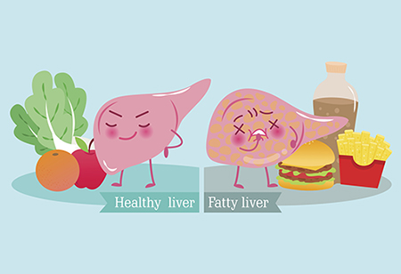 What is fatty liver disease?