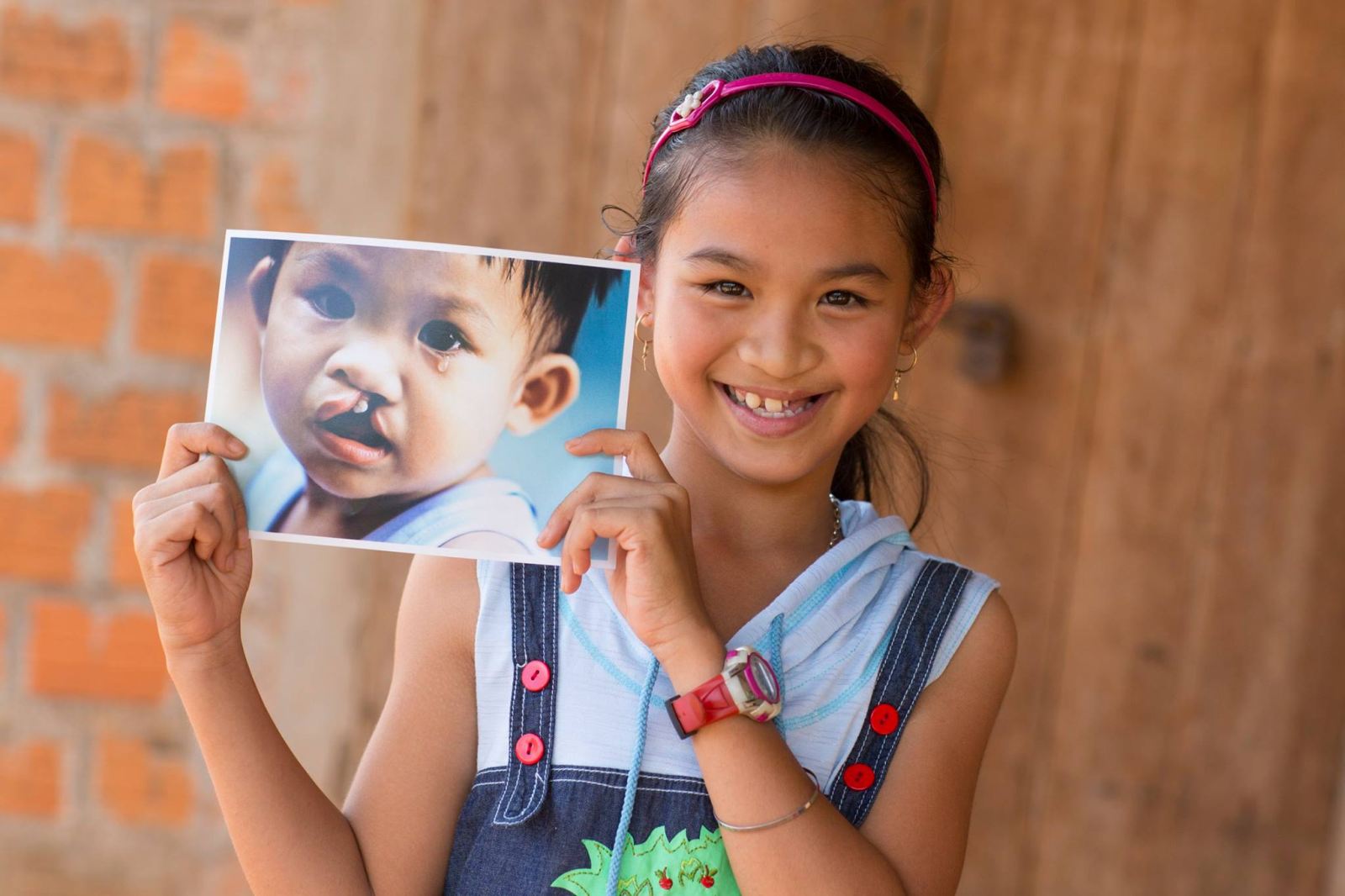 free medical check ups and surgeries for children born with facial deformities in hanoi