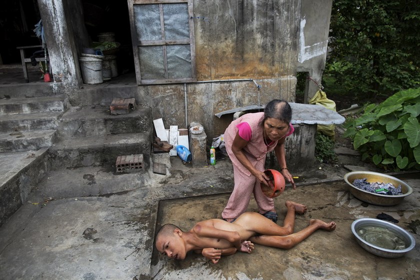 Vietnam Calls For Justice For Agent Orange Victims Vietnam Times