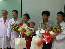 conjoined twins successfully separated at hcm citys hospital